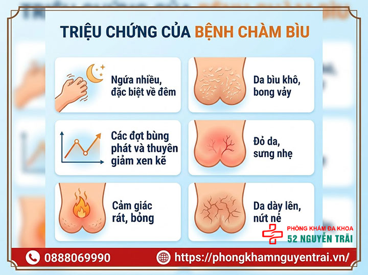 Bệnh Chàm Bìu: Nguyên Nhân, Triệu Chứng Và Điều Trị 4 Triệu chứng của bệnh chàm bìu