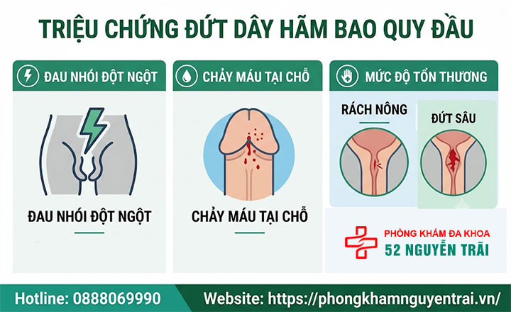 Đứt dây hãm bao quy đầu: Nguyên nhân, cách sơ cứu và điều trị 2 Triệu chứng đứt dây hãm bao quy đầu