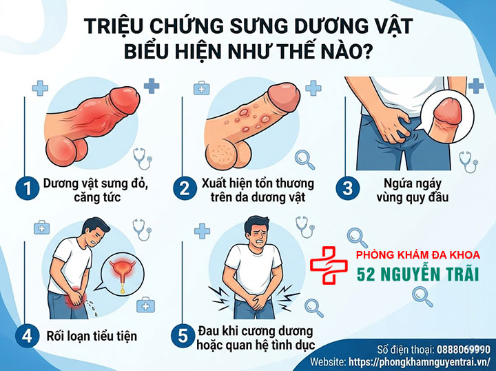 Dương vật bị sưng: Nguyên nhân, dấu hiệu và cách xử lý an toàn 1 Triệu chứng sưng dương vật biểu hiện như thế nào?