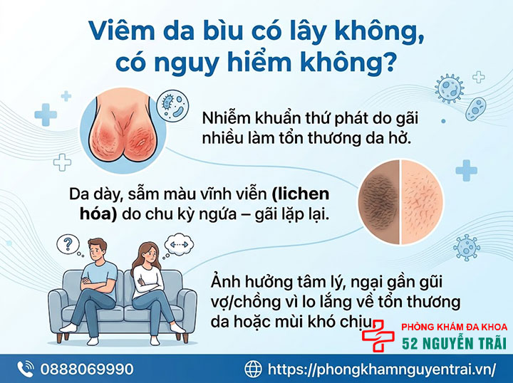 Viêm Da Bìu Là Gì? Nguyên Nhân Và Cách Điều Trị 3 Viêm da bìu có lây không, có nguy hiểm không?
