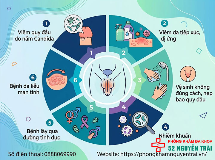 Ngứa Dương Vật: Nguyên Nhân Và Cách Xử Lý Đúng 2 nguyên nhân gây ngứa dương vật