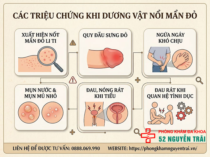 Dương vật nổi mẫn đỏ: Nguyên nhân và cách điều trị an toàn 1 triệu chứng Dương vật nổi mẫn đỏ