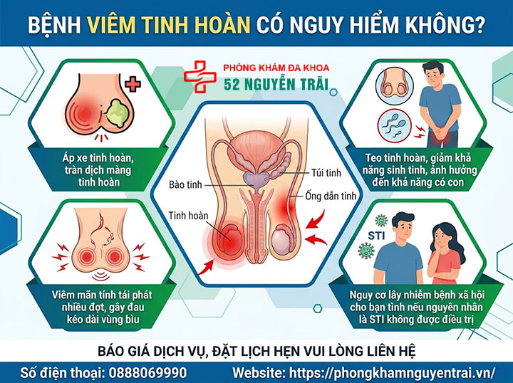 Viêm tinh hoàn là gì? Nguyên nhân, triệu chứng, cách điều trị 8 Bệnh Viêm Tinh Hoàn Có Nguy Hiểm Không?