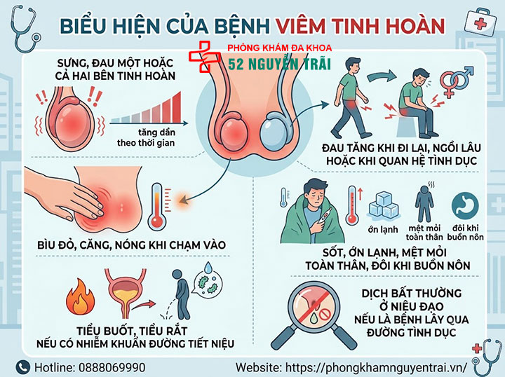 Viêm tinh hoàn là gì? Nguyên nhân, triệu chứng, cách điều trị 5 Biểu Hiện Của Bệnh Viêm Tinh Hoàn