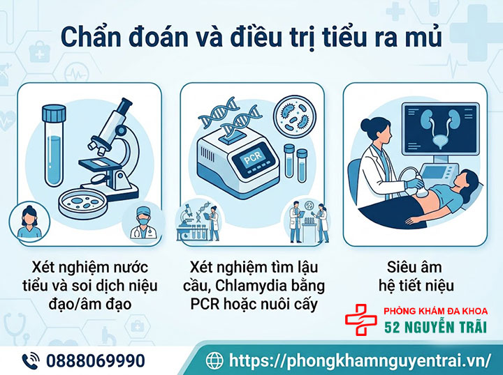 Tiểu Ra Mủ Là Bệnh Gì? Nguyên Nhân Và Cách Điều Trị 7 Chẩn đoán và điều trị tiểu ra mủ