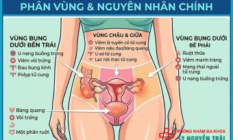Đau Bụng Dưới Ở Phụ Nữ: Nguyên Nhân Và Cách Xử Lý