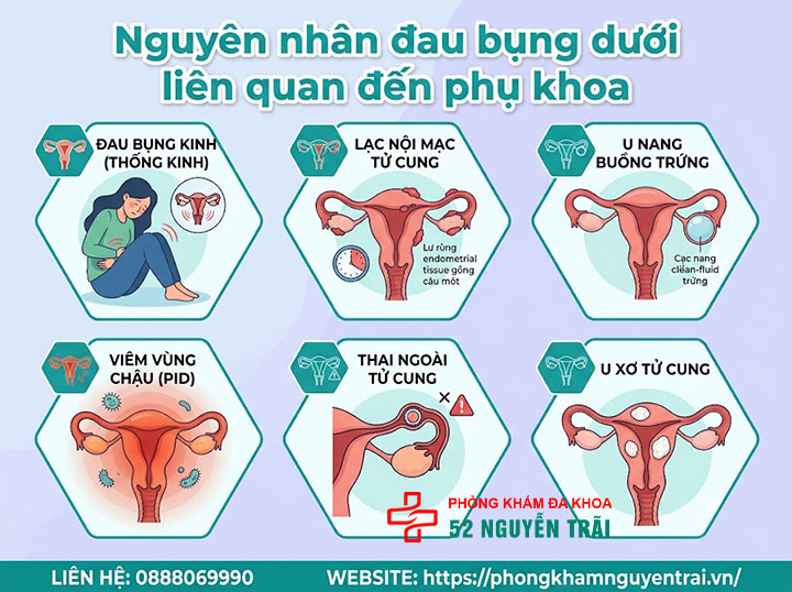 Đau Bụng Dưới Ở Phụ Nữ: Nguyên Nhân Và Cách Xử Lý 2 Nguyên nhân đau bụng dưới liên quan đến phụ khoa