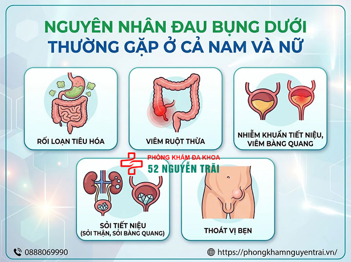 Đau Bụng Dưới Là Bệnh Gì? Nguyên Nhân Và Cách Xử Lý 3 Nguyên nhân đau bụng dưới thường gặp ở cả nam và nữ