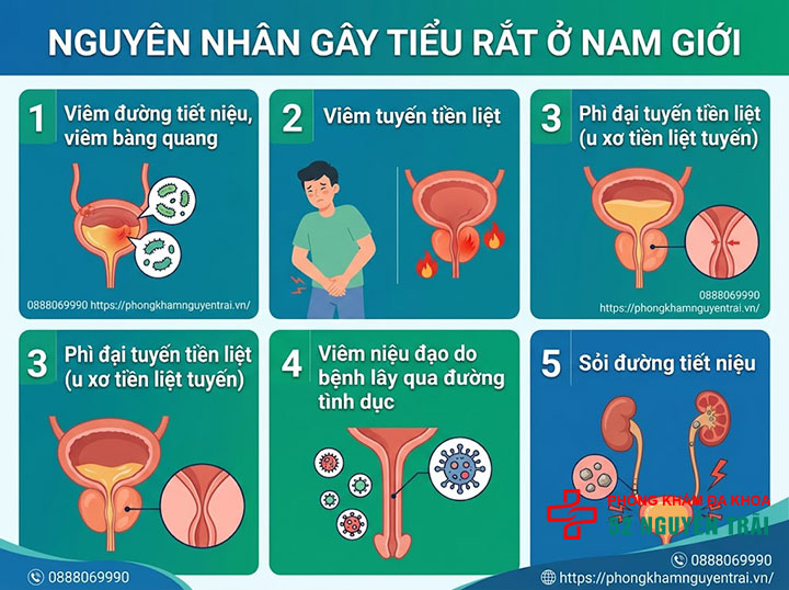 Tiểu Rắt Là Gì? Nguyên Nhân Và Cách Điều Trị Hiệu Quả 2 Nguyên nhân gây tiểu rắt Ở nam giới