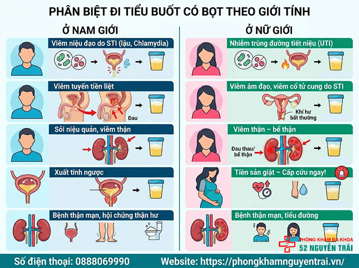 Đi Tiểu Buốt Có Bọt: Nguyên Nhân Và Khi Nào Cần Khám 8 Phân Biệt Đi Tiểu Buốt Có Bọt Theo Giới Tính