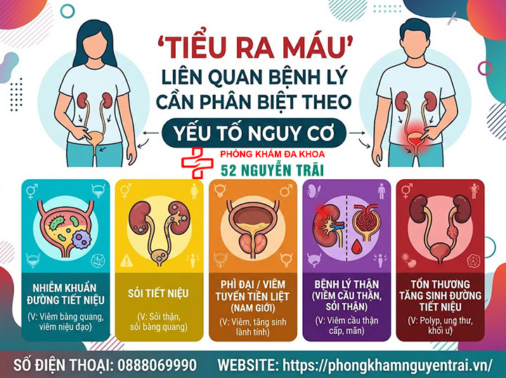 Tiểu Ra Máu: Khi Nào Lành Tính, Khi Nào Nguy Hiểm? 4 Tiểu ra máu liên quan bệnh lý cần phân biệt theo yếu tố nguy cơ
