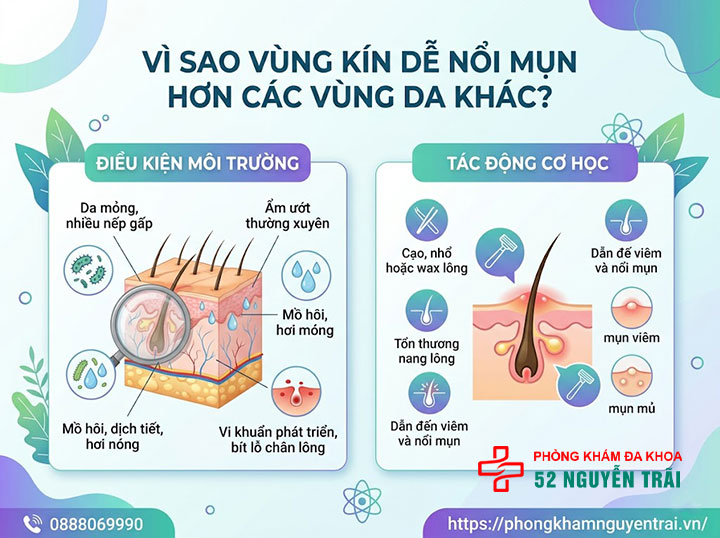 Nổi Mụn Ở Cô Bé: Nguyên Nhân Và Cách Xử Lý 2 Vì sao vùng kín dễ nổi mụn hơn các vùng da khác?