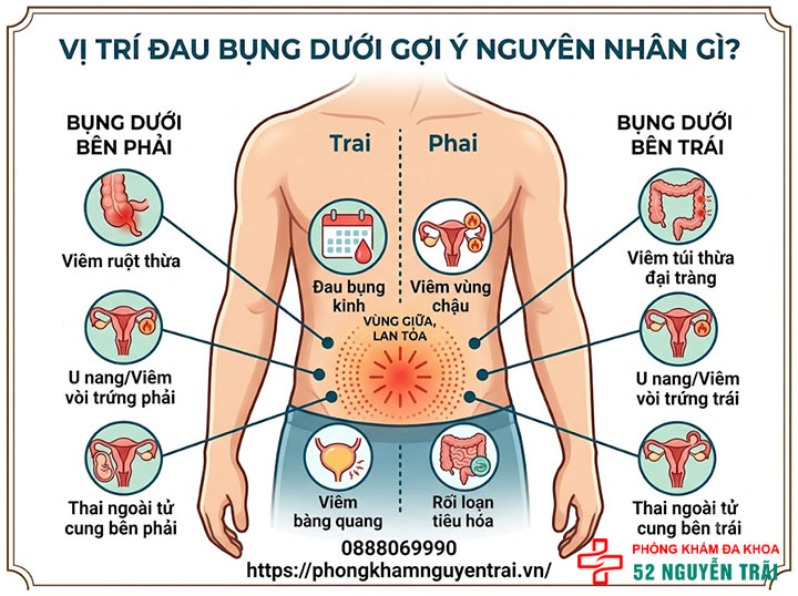 Đau Bụng Dưới Ở Phụ Nữ: Nguyên Nhân Và Cách Xử Lý 4 Vị trí đau bụng dưới gợi ý nguyên nhân gì?
