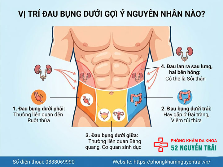 Đau Bụng Dưới Là Bệnh Gì? Nguyên Nhân Và Cách Xử Lý 2 Vị trí đau gợi ý nguyên nhân nào?