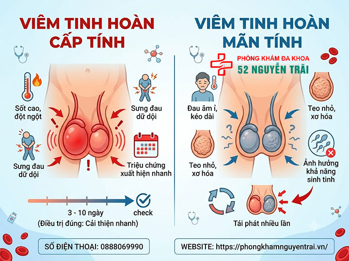 Viêm tinh hoàn là gì? Nguyên nhân, triệu chứng, cách điều trị 6 Viêm Tinh Hoàn Cấp Tính Và Viêm Tinh Hoàn Mãn Tính