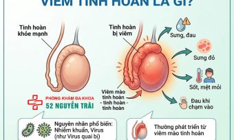 Viêm tinh hoàn là gì? Nguyên nhân, triệu chứng, cách điều trị