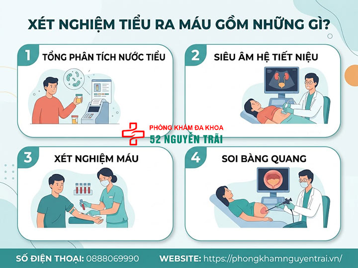 Tiểu Ra Máu: Khi Nào Lành Tính, Khi Nào Nguy Hiểm? 6 Xét nghiệm tiểu ra máu gồm những gì?