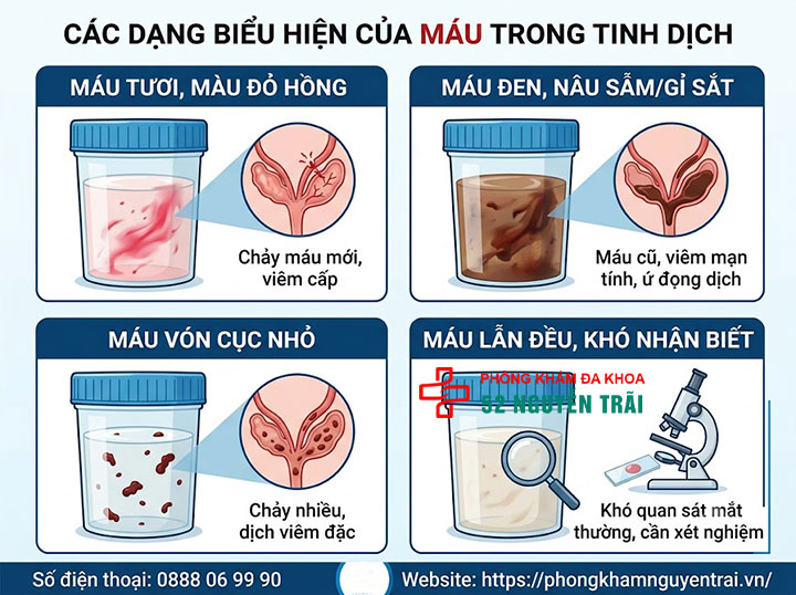 Xuất Tinh Ra Máu Là Bệnh Gì? Nguyên Nhân Và Cách Xử Trí 2 Các dạng biểu hiện thường gặp: máu tươi, máu đen, vón cục, lẫn trong tinh dịch