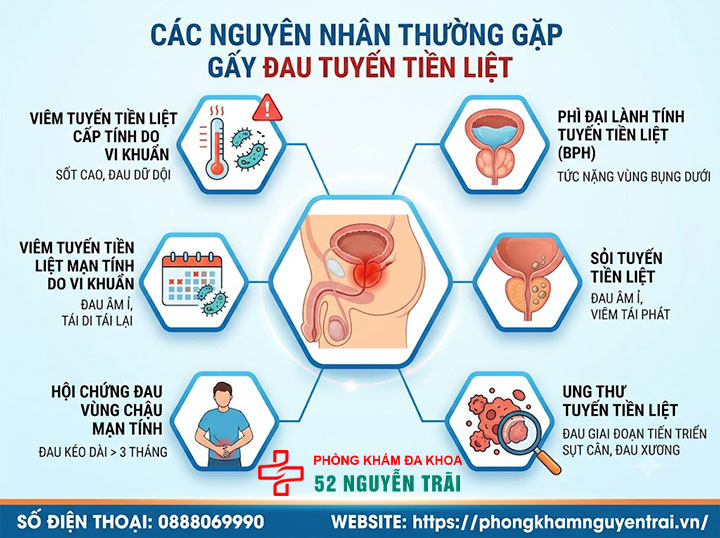 Đau tuyến tiền liệt là bệnh gì? Nguyên nhân, cách xử lý 2 Các nguyên nhân thường gặp gây đau tuyến tiền liệt