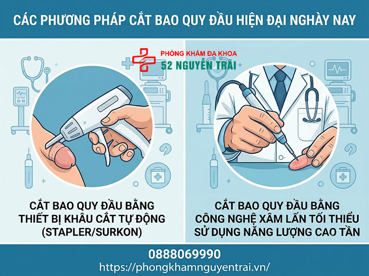 Cắt bao quy đầu là gì? Lợi ích và các phương pháp hiện đại 3 Các phương pháp cắt bao quy đầu hiện đại