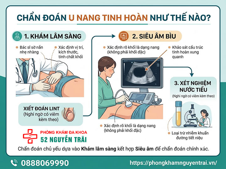 U Nang Tinh Hoàn Là Gì? Nguyên Nhân Và Cách Điều Trị 5 Chẩn đoán u nang tinh hoàn như thế nào?