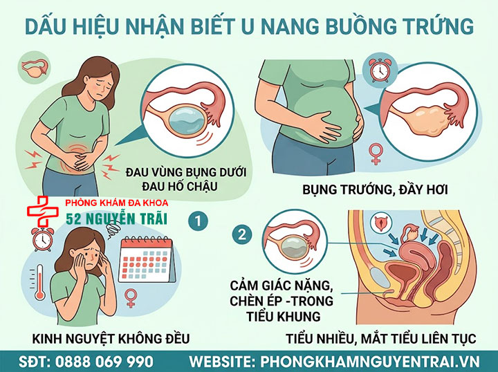 U nang buồng trứng là gì? Nguyên nhân, dấu hiệu, điều trị 7 Dấu hiệu nhận biết u nang buồng trứng