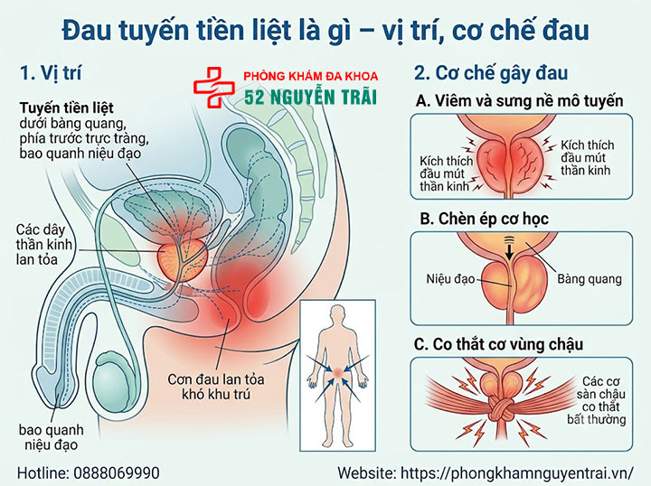 Đau tuyến tiền liệt là bệnh gì? Nguyên nhân, cách xử lý 1 Đau tuyến tiền liệt là gì – vị trí, cơ chế đau