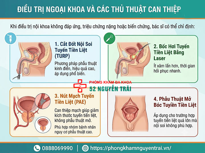 Phì đại tuyến tiền liệt là gì? Nguyên nhân, triệu chứng 13 Điều trị ngoại khoa và các thủ thuật can thiệp