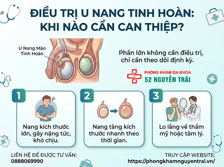 U Nang Tinh Hoàn Là Gì? Nguyên Nhân Và Cách Điều Trị 6 Điều trị u nang tinh hoàn: khi nào cần can thiệp?