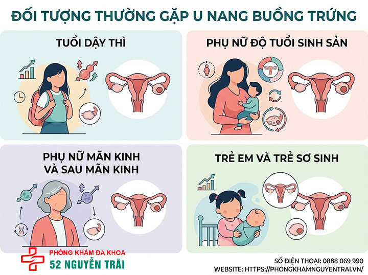 U nang buồng trứng là gì? Nguyên nhân, dấu hiệu, điều trị 5 Đối tượng thường gặp u nang buồng trứng