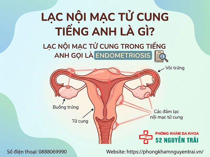 Lạc Nội Mạc Tử Cung Là Gì? Nguyên Nhân, Phân Loại 8 Lạc nội mạc tử cung tiếng Anh là gì?
