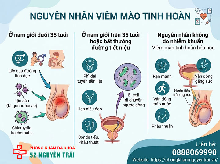 Viêm Mào Tinh Hoàn Là Gì? Nguyên Nhân Và Cách Điều Trị 3 Nguyên Nhân Viêm Mào Tinh Hoàn
