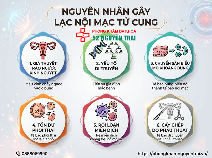 Lạc Nội Mạc Tử Cung Là Gì? Nguyên Nhân, Phân Loại 4 Nguyên nhân gây lạc nội mạc tử cung