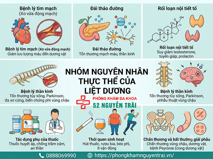 Bệnh liệt dương là gì? Triệu chứng, nguyên nhân và cách chữa 5 Nhóm nguyên nhân thực thể liệt dương
