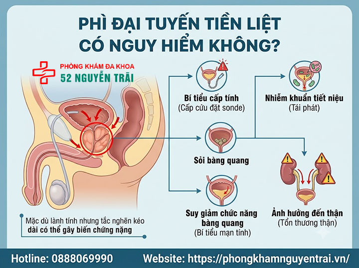 Phì đại tuyến tiền liệt là gì? Nguyên nhân, triệu chứng 8 Phì đại tuyến tiền liệt có nguy hiểm không?
