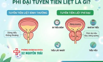 Phì đại tuyến tiền liệt là gì? Nguyên nhân, triệu chứng