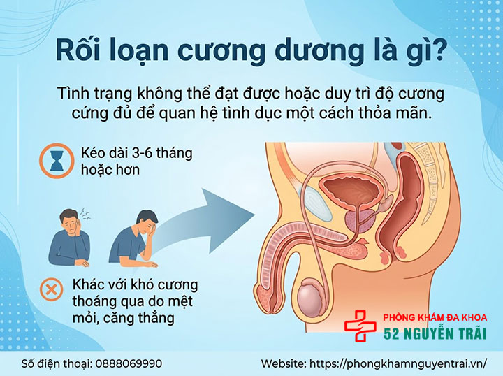 Rối loạn cương dương là gì? Nguyên nhân, cách điều trị 1 Rối loạn cương dương là gì?