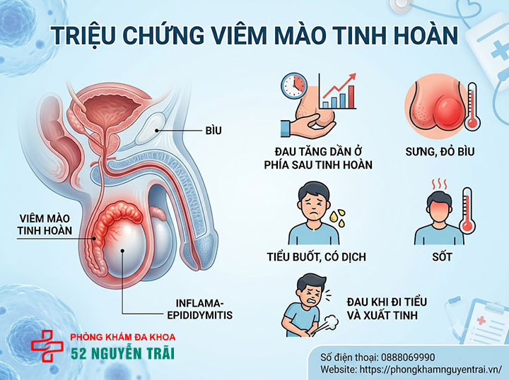 Viêm Mào Tinh Hoàn Là Gì? Nguyên Nhân Và Cách Điều Trị 4 Triệu Chứng Viêm Mào Tinh Hoàn