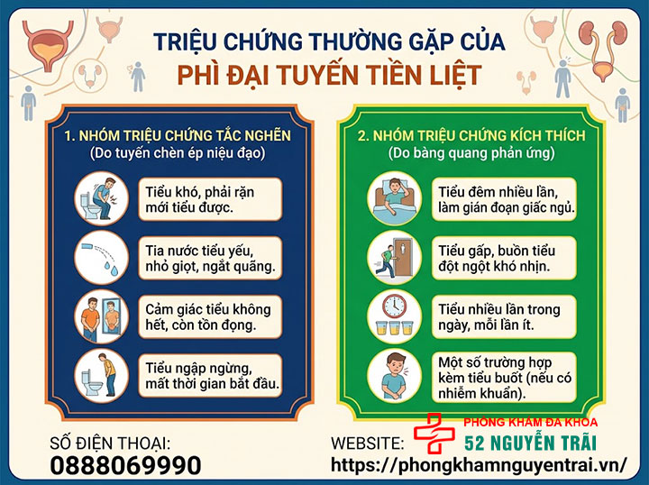 Phì đại tuyến tiền liệt là gì? Nguyên nhân, triệu chứng 6 Triệu chứng thường gặp của phì đại tuyến tiền liệt