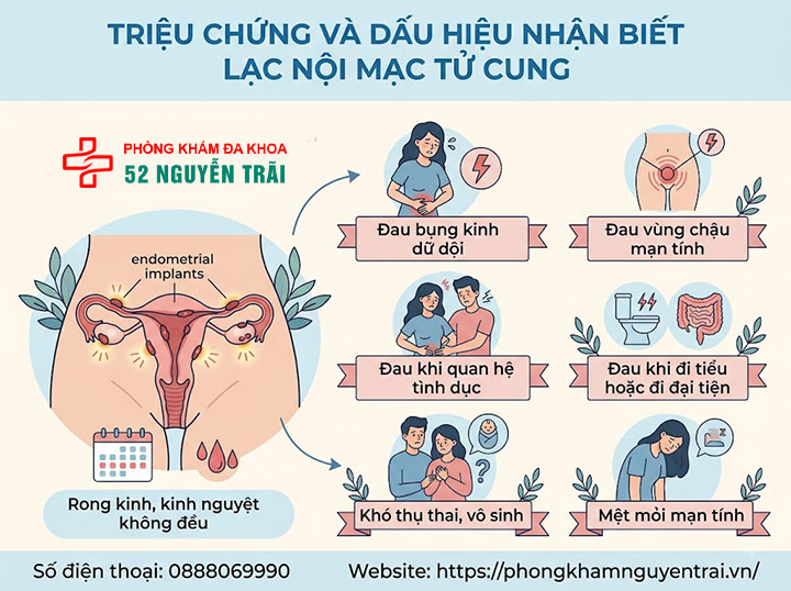 Lạc Nội Mạc Tử Cung Là Gì? Nguyên Nhân, Phân Loại 5 Triệu chứng và dấu hiệu nhận biết lạc nội mạc tử cung