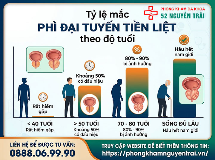 Phì đại tuyến tiền liệt là gì? Nguyên nhân, triệu chứng 4 Tỷ lệ mắc phì đại tuyến tiền liệt theo độ tuổi