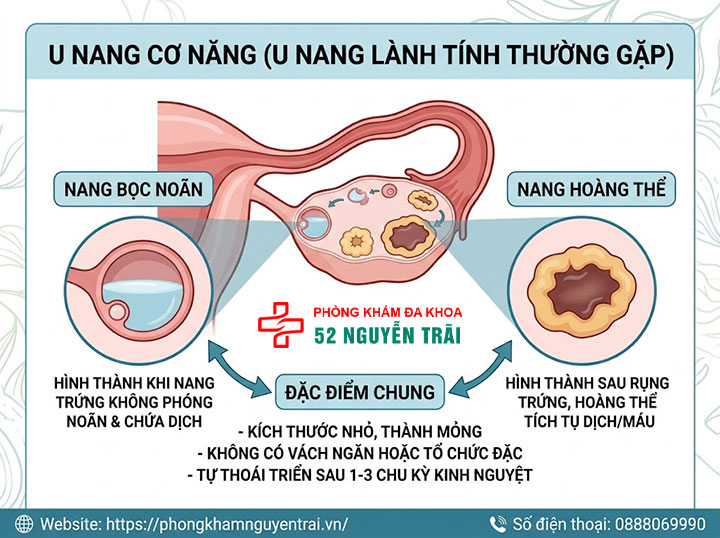 U nang buồng trứng là gì? Nguyên nhân, dấu hiệu, điều trị 2 U nang cơ năng (functional cysts)