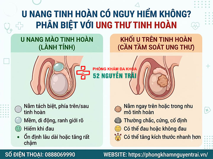 U Nang Tinh Hoàn Là Gì? Nguyên Nhân Và Cách Điều Trị 4 U nang tinh hoàn có nguy hiểm không? Phân biệt với ung thư tinh hoàn