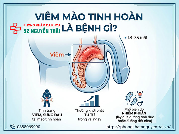 Viêm Mào Tinh Hoàn Là Gì? Nguyên Nhân Và Cách Điều Trị 2 Viêm Mào Tinh Hoàn Là Bệnh Gì?