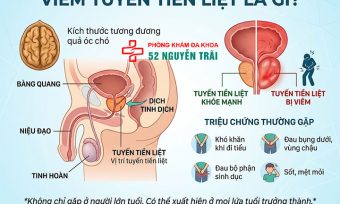 Viêm tuyến tiền liệt là gì? Phân loại và nguy cơ mắc bệnh