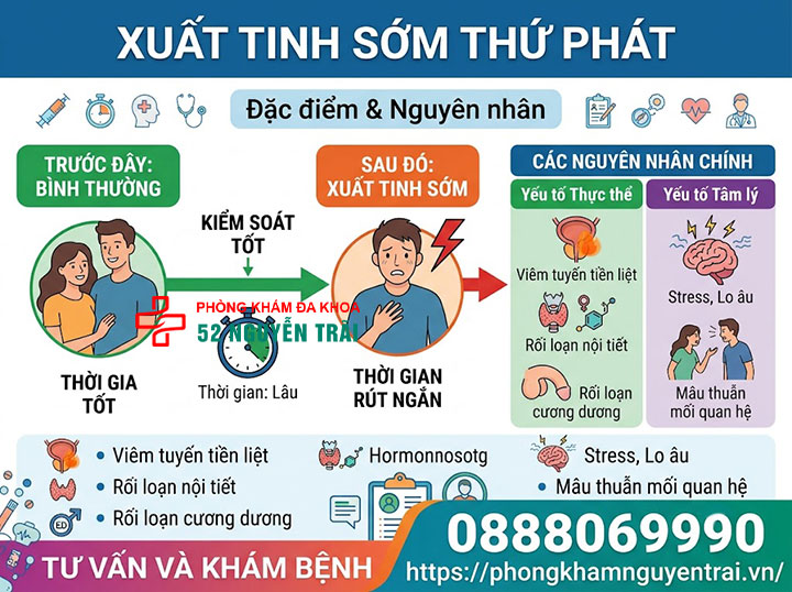 Xuất tinh sớm là gì? Nguyên nhân, phân loại chi tiết 3 Xuất tinh sớm thứ phát