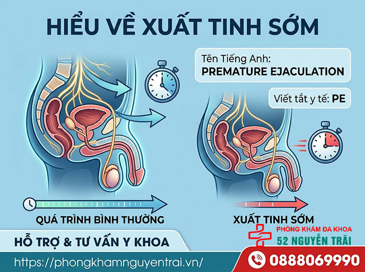 Xuất tinh sớm là gì? Nguyên nhân, phân loại chi tiết 10 Xuất tinh sớm tiếng Anh là gì?