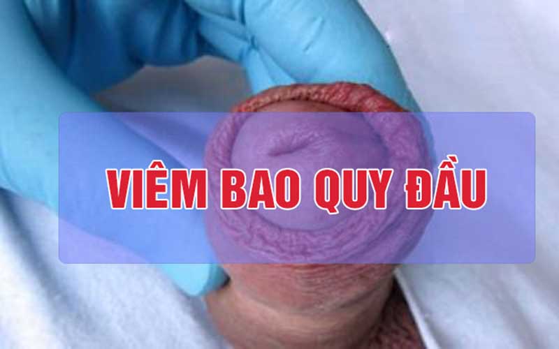 Nam giới bị dài bao quy đầu có thể gặp các nguy cơ 