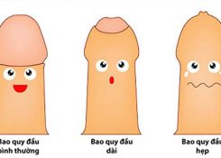 Dài hẹp bao quy đầu là gì? Phương pháp điều trị hiệu quả