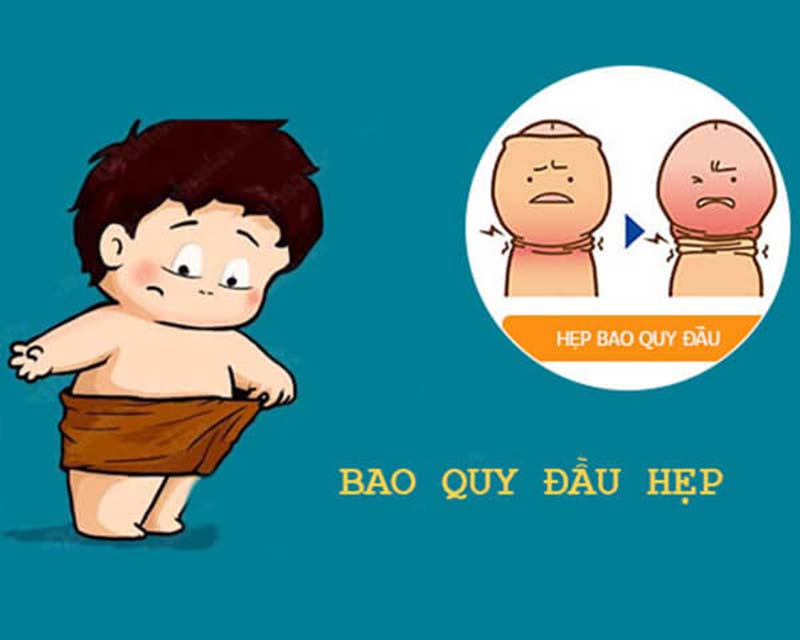 Trẻ bị hẹp bao quy đầu có sao không?